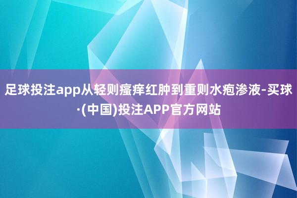 足球投注app从轻则瘙痒红肿到重则水疱渗液-买球·(中国)投注APP官方网站